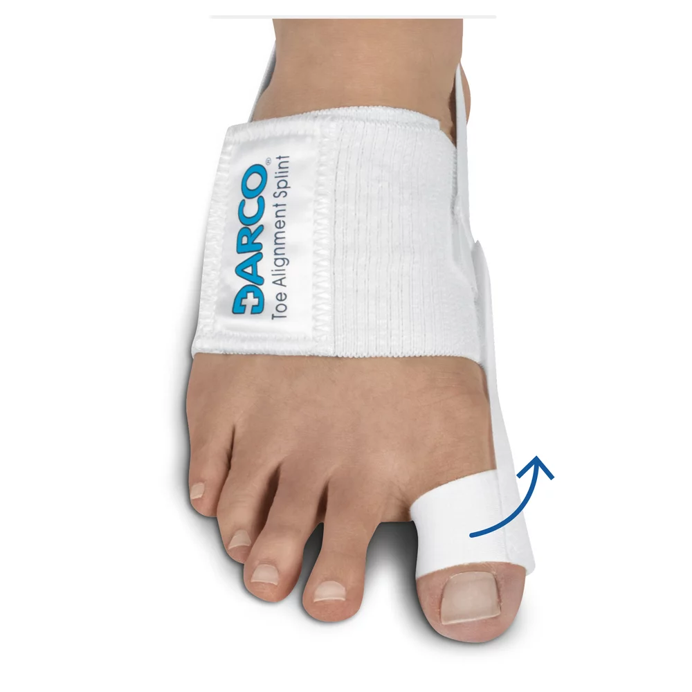 Toe Alignment Splint